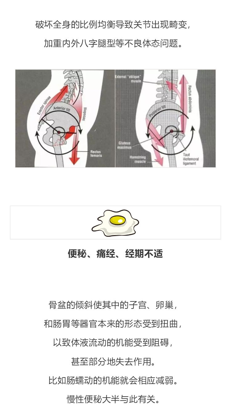 骨盆2_08.jpg